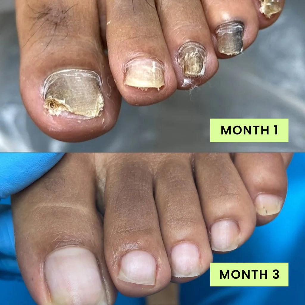 Customer progress example
